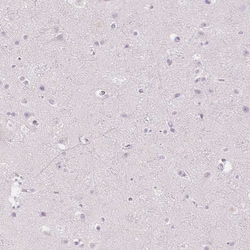 Invitrogen CD206 Polyclonal Antibody 100 &mu;L; Unconjugated:Antibodies,