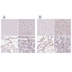 Invitrogen CD206 Polyclonal Antibody 100 &mu;L | Buy Online | Invitrogen&trade; | Fisher Scientific