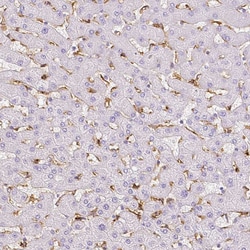 Invitrogen CD206 Polyclonal Antibody 100 &mu;L; Unconjugated:Antibodies,