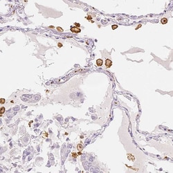 Invitrogen CD206 Polyclonal Antibody 100 &mu;L; Unconjugated:Antibodies,