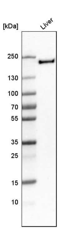 Invitrogen CD206 Polyclonal Antibody 100 &mu;L | Buy Online | Invitrogen&trade; | Fisher Scientific