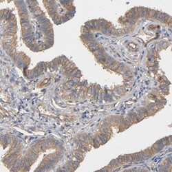 Invitrogen MARS Polyclonal Antibody 100 &mu;L; Unconjugated:Antibodies,