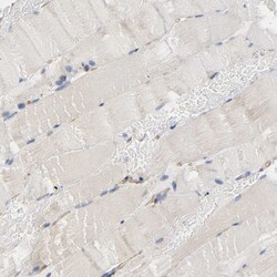 Invitrogen MARS Polyclonal Antibody 100 &mu;L; Unconjugated:Antibodies,