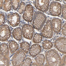 Invitrogen MARS Polyclonal Antibody 100 &mu;L; Unconjugated:Antibodies,