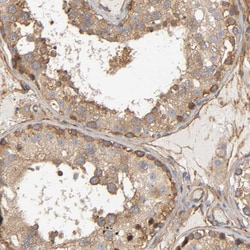 Invitrogen MARS Polyclonal Antibody 100 &mu;L; Unconjugated:Antibodies,
