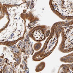 Invitrogen Laminin beta-1 Polyclonal Antibody 100 &mu;L; Unconjugated:Antibodies,