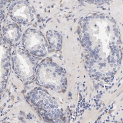 Invitrogen Laminin beta-1 Polyclonal Antibody 100 &mu;L; Unconjugated:Antibodies,