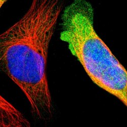 Invitrogen CRABP2 Polyclonal Antibody 100 &mu;L; Unconjugated:Antibodies,