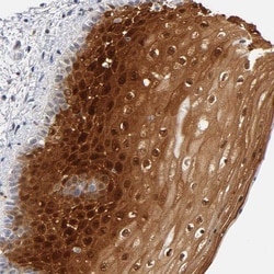 Invitrogen CRABP2 Polyclonal Antibody 100 &mu;L; Unconjugated:Antibodies,