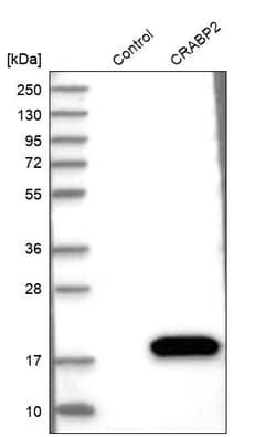 Invitrogen CRABP2 Polyclonal Antibody 100 &mu;L; Unconjugated:Antibodies,