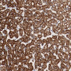 Invitrogen GIT1 Polyclonal Antibody 100 &mu;L | Buy Online | Invitrogen&trade; | Fisher Scientific