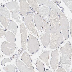 Invitrogen GIT1 Polyclonal Antibody 100 &mu;L | Buy Online | Invitrogen&trade; | Fisher Scientific