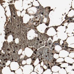 Invitrogen S100A9 Polyclonal Antibody 100 &mu;L; Unconjugated:Antibodies,