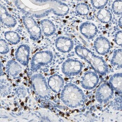 Invitrogen S100A9 Polyclonal Antibody 100 &mu;L; Unconjugated:Antibodies,