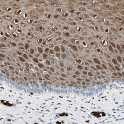 Invitrogen S100A9 Polyclonal Antibody 100 &mu;L; Unconjugated:Antibodies,