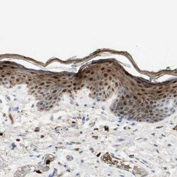 Invitrogen S100A9 Polyclonal Antibody 100 &mu;L; Unconjugated:Antibodies,