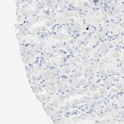Invitrogen S100A9 Polyclonal Antibody 100 &mu;L; Unconjugated:Antibodies,