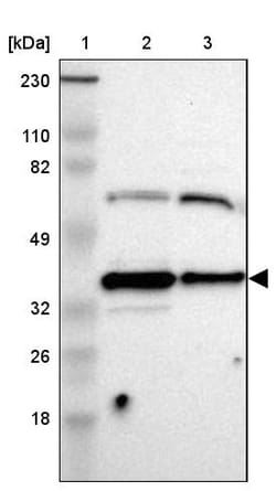 Invitrogen AMPK beta-1 Polyclonal Antibody 100 &mu;L; Unconjugated:Antibodies,