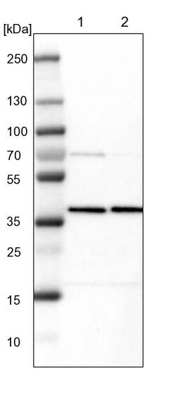 Invitrogen AMPK beta-1 Polyclonal Antibody 100 &mu;L; Unconjugated:Antibodies,