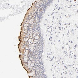 Invitrogen CYP4B1 Polyclonal Antibody 100 &mu;L; Unconjugated:Antibodies,