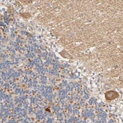 Invitrogen ARPC1A Polyclonal Antibody 100 &mu;L; Unconjugated:Antibodies,