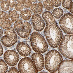 Invitrogen ARPC1A Polyclonal Antibody 100 &mu;L; Unconjugated:Antibodies,