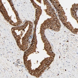 Invitrogen PSAP Polyclonal Antibody 100 &mu;L; Unconjugated:Antibodies,