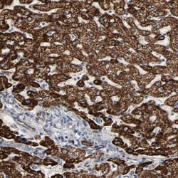Invitrogen ACAT1 Polyclonal Antibody 100 &mu;L | Buy Online | Invitrogen&trade; | Fisher Scientific