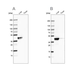 Invitrogen ACAT1 Polyclonal Antibody 100 &mu;L | Buy Online | Invitrogen&trade; | Fisher Scientific