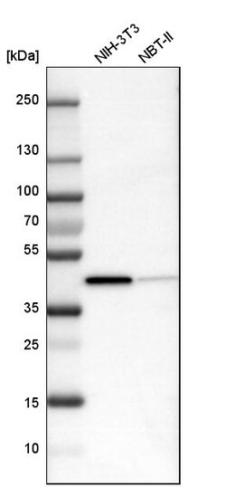 Invitrogen ACAT1 Polyclonal Antibody 100 &mu;L | Buy Online | Invitrogen&trade; | Fisher Scientific