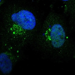 ZNF75D Polyclonal Antibody:Antibodies, Polyclonal