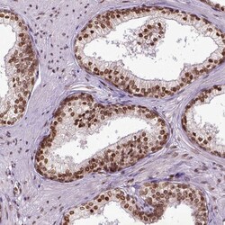 ZNF75D Polyclonal Antibody:Antibodies, Polyclonal