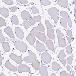Invitrogen TGM3 Polyclonal Antibody 100 &mu;L; Unconjugated:Antibodies,