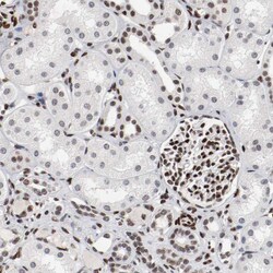 Invitrogen MEF2D Polyclonal Antibody 100 &mu;L; Unconjugated:Antibodies,