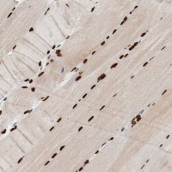 Invitrogen MEF2D Polyclonal Antibody 100 &mu;L; Unconjugated:Antibodies,