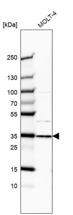 Invitrogen GTF2E2 Polyclonal Antibody 100 &mu;L; Unconjugated:Antikroppar
