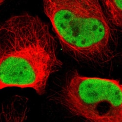 Invitrogen MCM6 Polyclonal Antibody 100 &mu;L; Unconjugated:Antibodies,