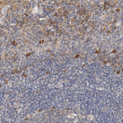 Invitrogen APRIL Polyclonal Antibody 100 &mu;L; Unconjugated:Antibodies,