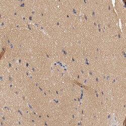 HGS Polyclonal Antibody:Antibodies, Polyclonal