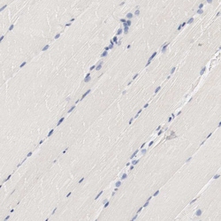 HGS Polyclonal Antibody:Antibodies, Polyclonal