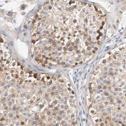 HGS Polyclonal Antibody:Antibodies, Polyclonal