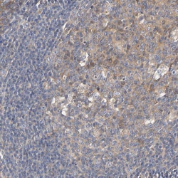 HGS Polyclonal Antibody:Antibodies, Polyclonal