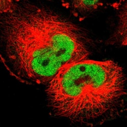 Invitrogen Cyclin T1 Polyclonal Antibody 100 &mu;L; Unconjugated:Antibodies,