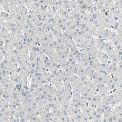 Invitrogen Cyclin T1 Polyclonal Antibody 100 &mu;L; Unconjugated:Antibodies,