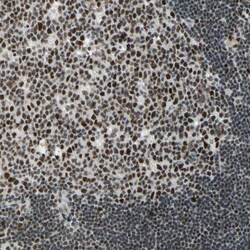 Invitrogen Cyclin T1 Polyclonal Antibody 100 &mu;L; Unconjugated:Antibodies,