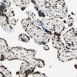 Invitrogen Cyclin T1 Polyclonal Antibody 100 &mu;L; Unconjugated:Antibodies,