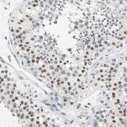 Invitrogen Cyclin T1 Polyclonal Antibody 100 &mu;L; Unconjugated:Antibodies,