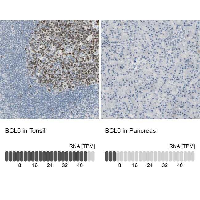 BCL6 Polyclonal Antibody, Invitrogen™ 100 μL; Unconjugated | Fisher ...
