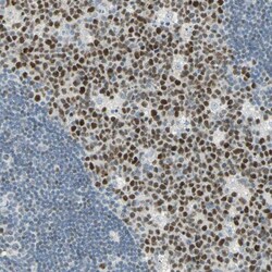 Invitrogen BCL6 Polyclonal Antibody 100 &mu;L; Unconjugated:Antibodies,