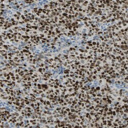 Invitrogen BCL6 Polyclonal Antibody 100 &mu;L; Unconjugated:Antibodies,